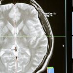 Infrared Radiation - Free stock photo of analysis, anatomy, brain
